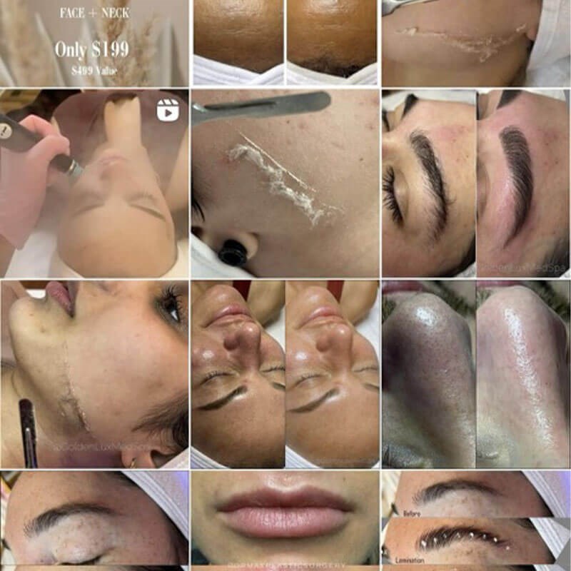 GoldenLux MedSpa