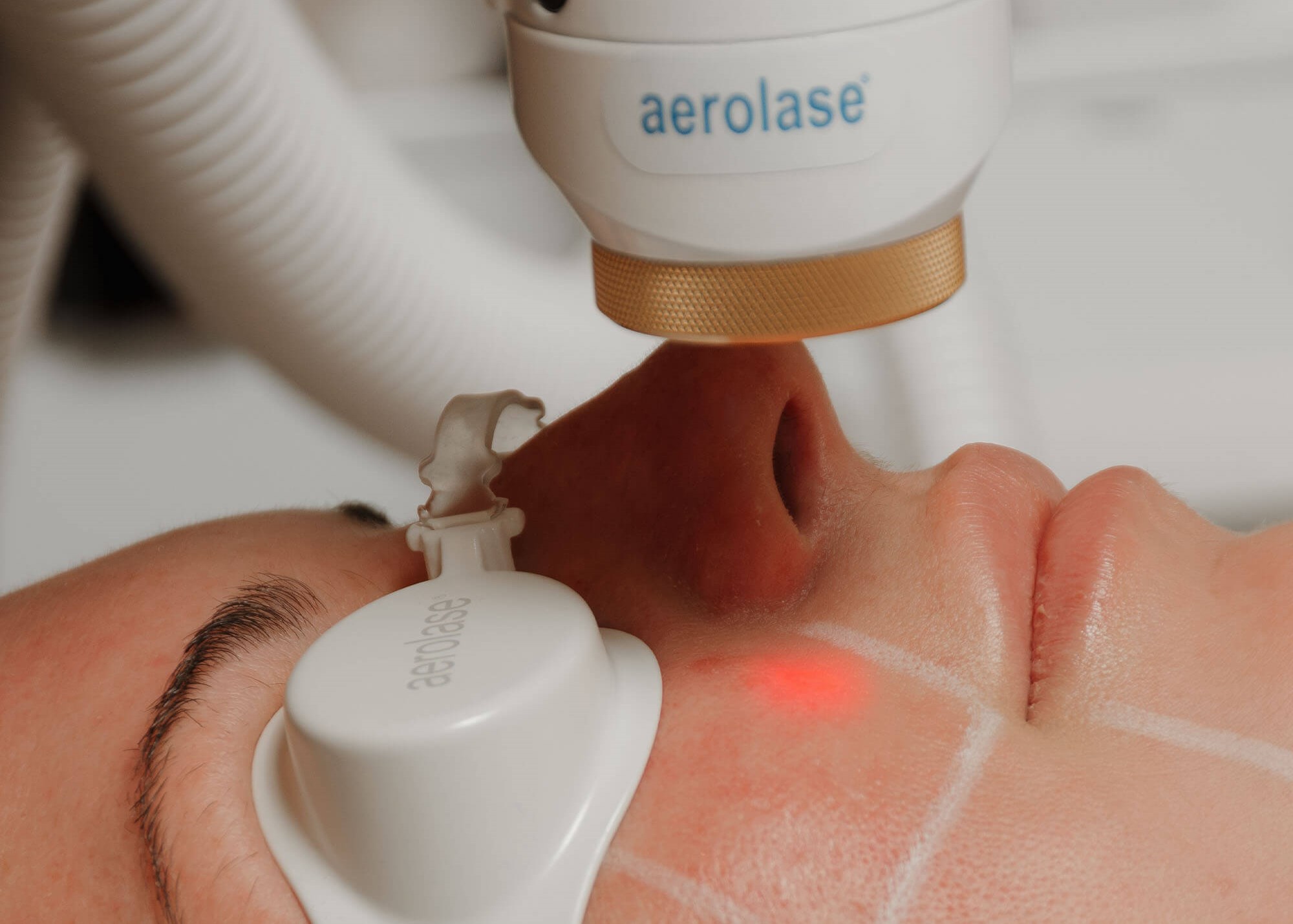 Laser Skin Treatment 